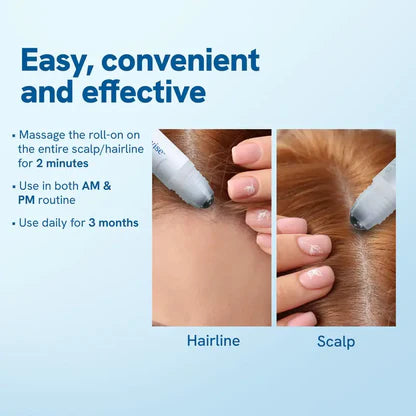 Roll- On Hair Growth Serum