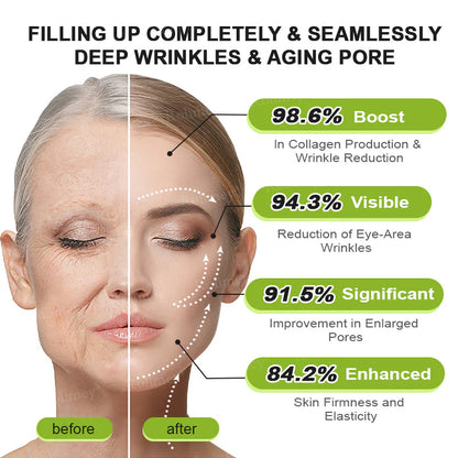 Botox & Vita A Retinol Shot Wrinkle Lift Tightening Cream